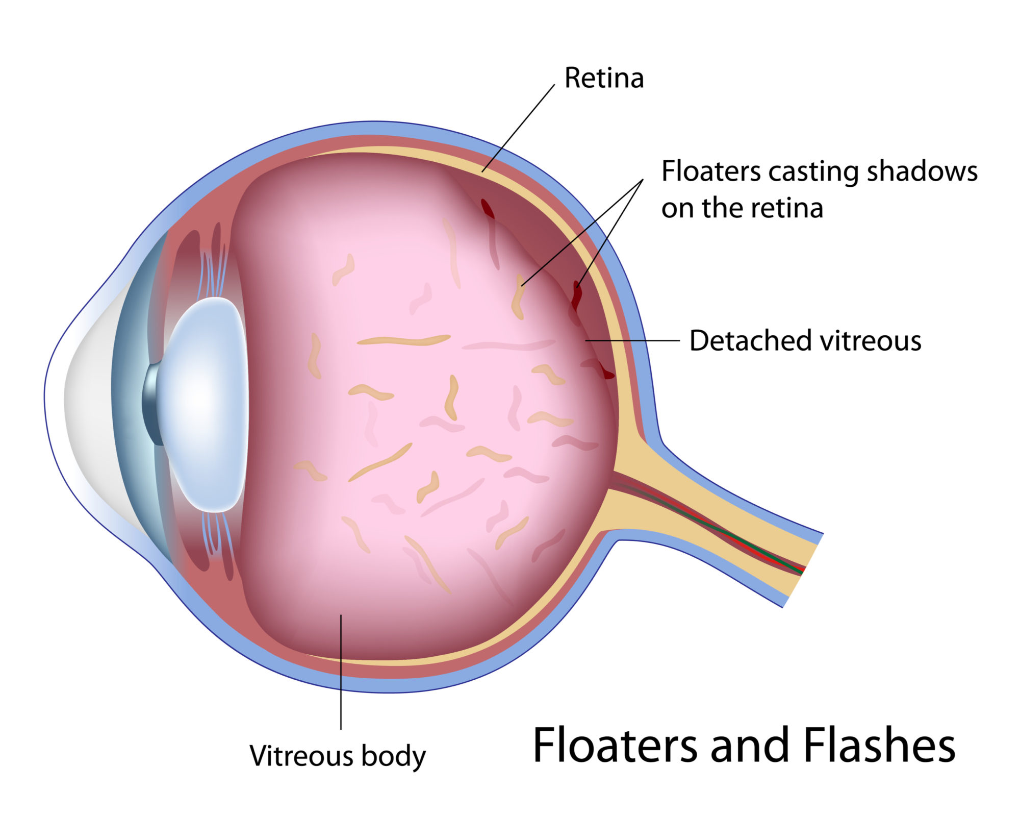 What is Retina in the Eye?